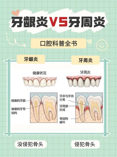 牙周炎什么症状