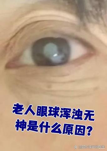 眼睛无神是什么原因