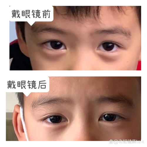 眼睛无神是什么原因