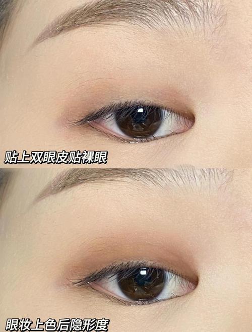 什么双眼皮贴