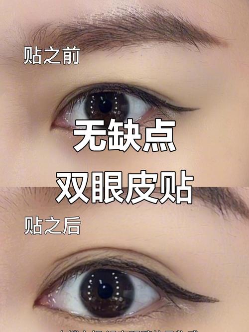 什么双眼皮贴