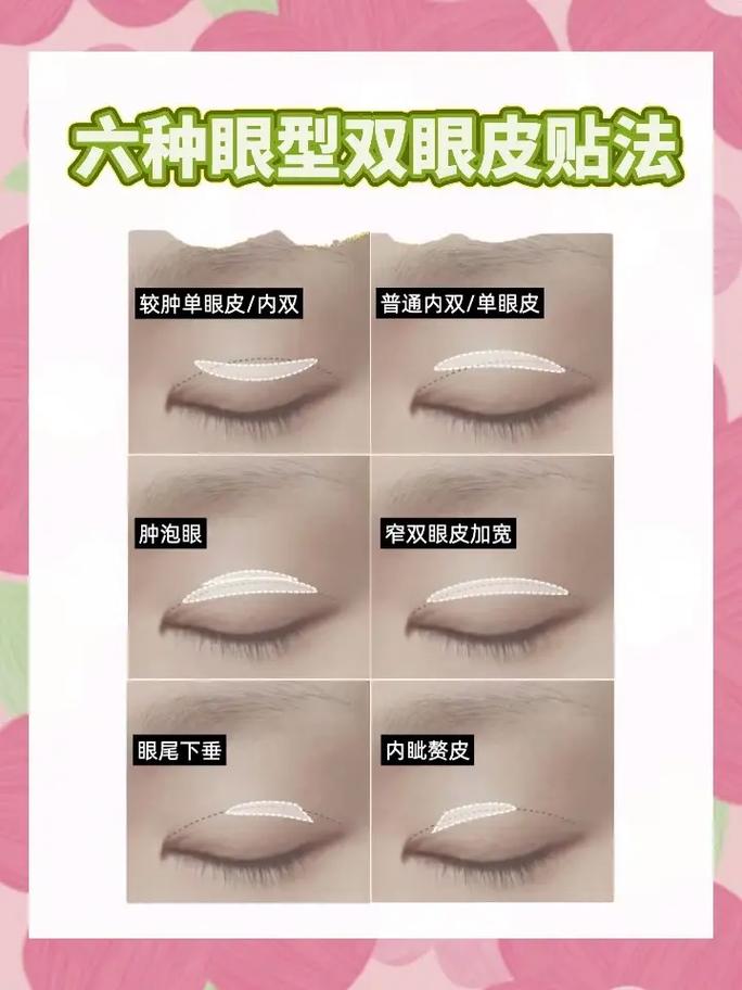 什么双眼皮贴