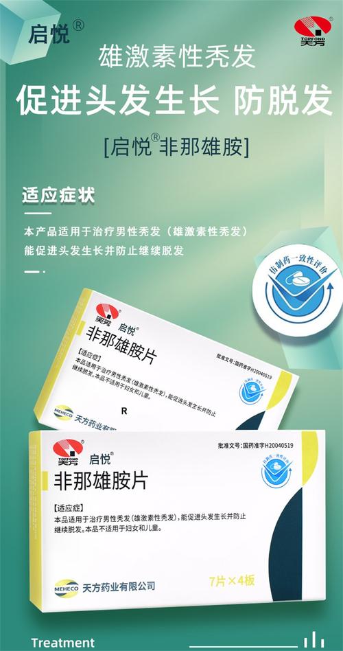 治疗斑秃用什么药