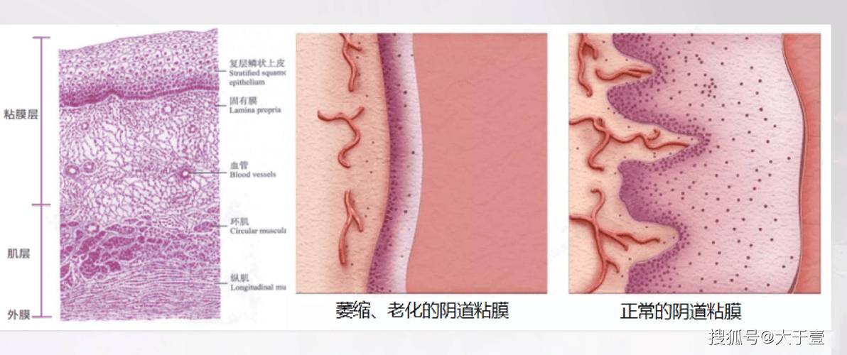 阴道为什么干涩