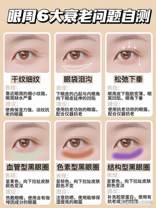 眼线有什么作用