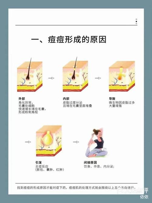 长青春痘是什么原因