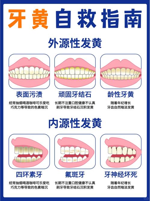 牙齿变黄是什么原因