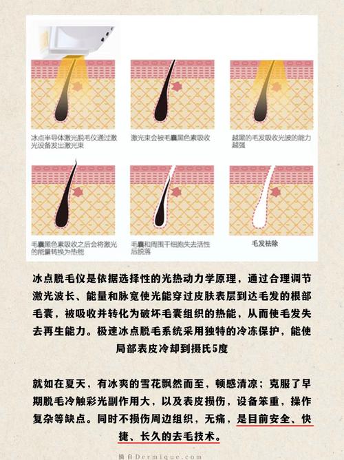 脱毛膏原理是什么