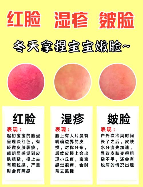 脸部过敏是什么原因