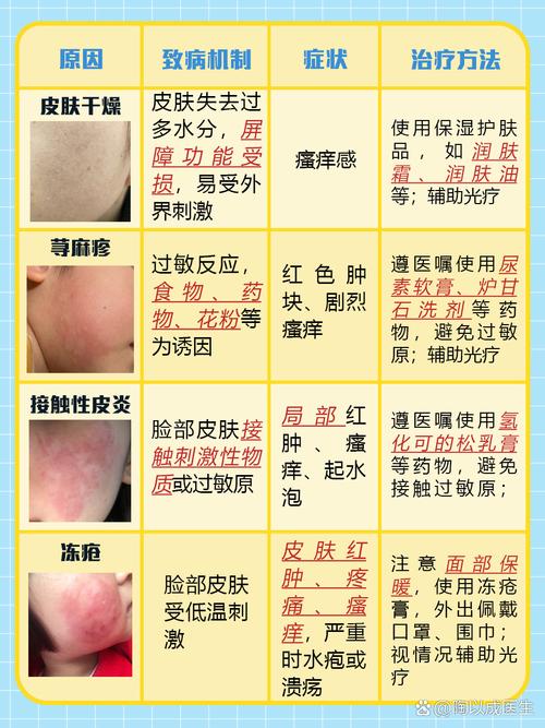 脸部过敏是什么原因