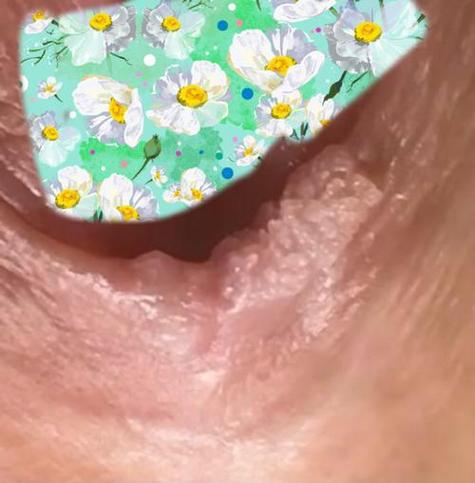 乳头长什么样图片