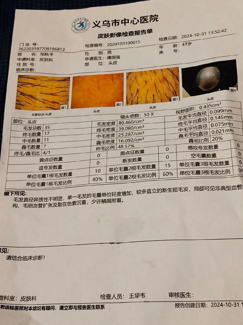 掉头发做什么检查
