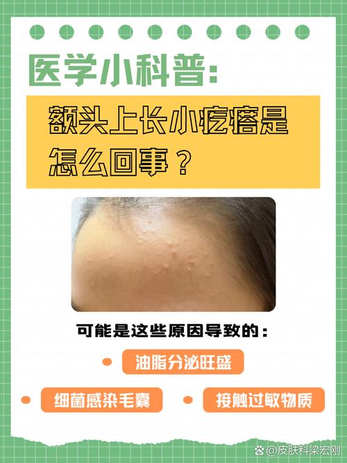 额头为什么会长痘痘