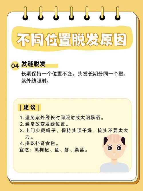 是什么原因导致脱发