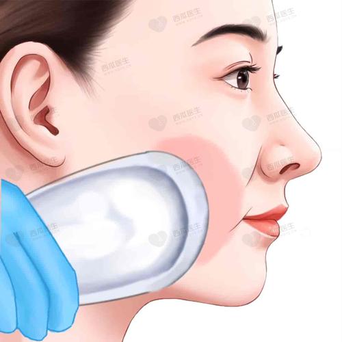 嘴角的纹叫什么