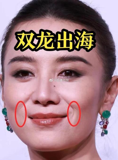 嘴角的纹叫什么