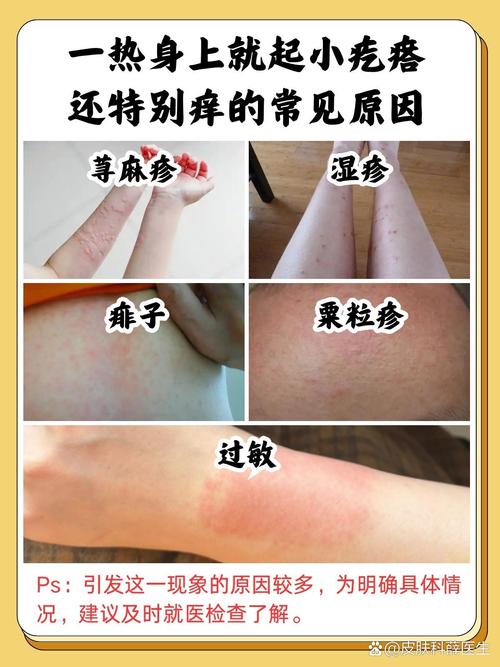 为什么运动会痒