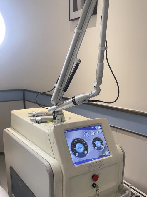 什么是激光减肥