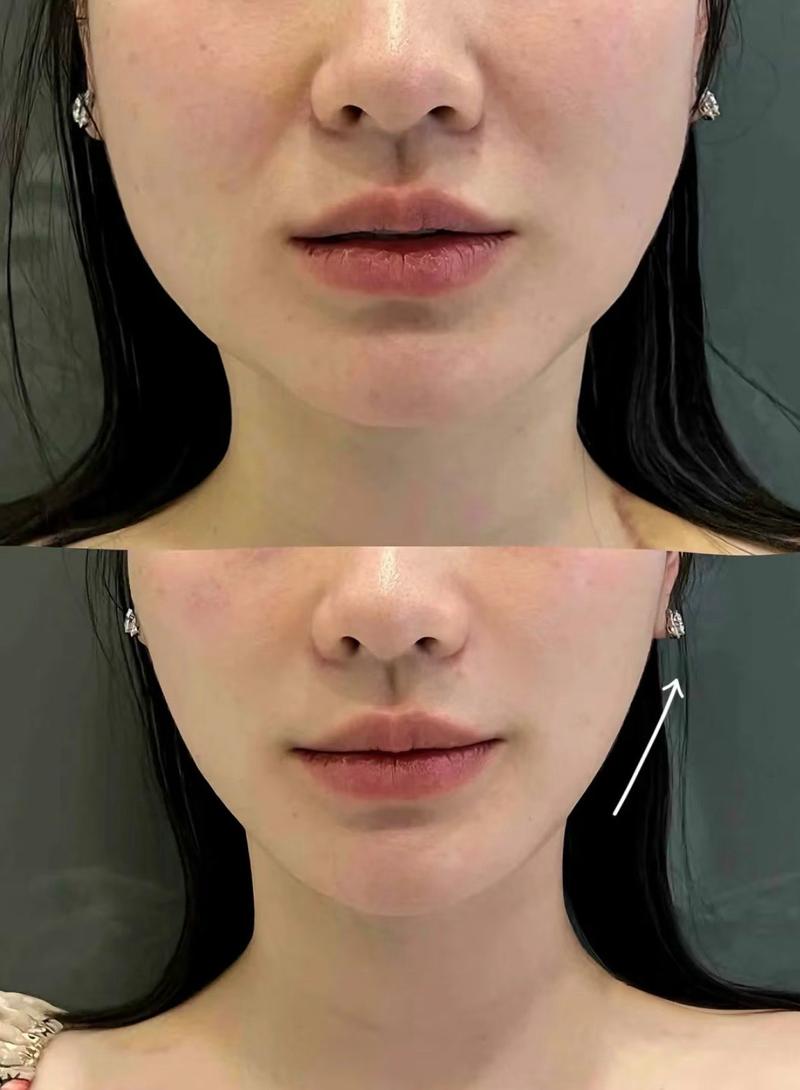 什么东西可以瘦脸