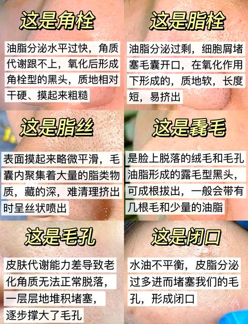 有什么办法去黑头