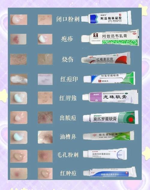 容易长痘的皮肤用什么护肤品