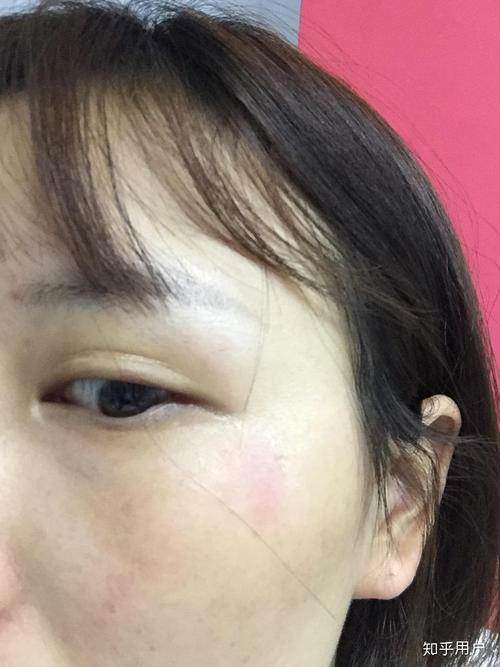 洗面奶洗脸后皮肤刺痛