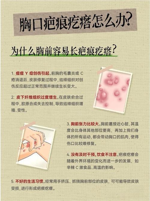 疤痕疙瘩挂什么科