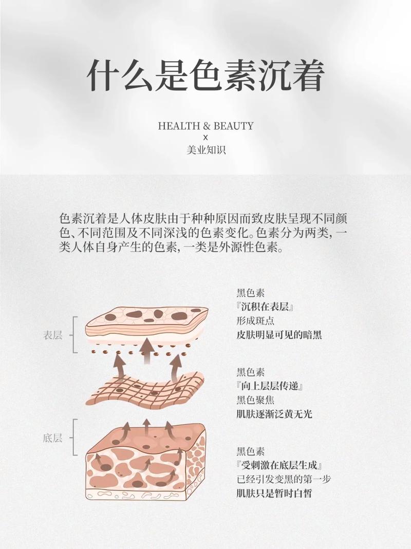 什么是黑色素沉淀