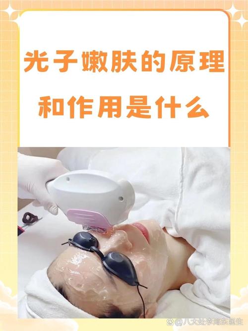 光子嫩肤是什么意思