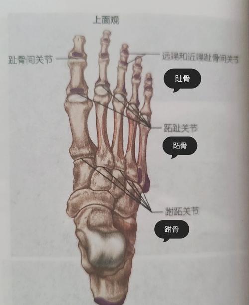 大脚骨是什么原因