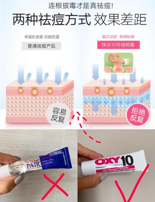 洗面奶过敏用什么药?