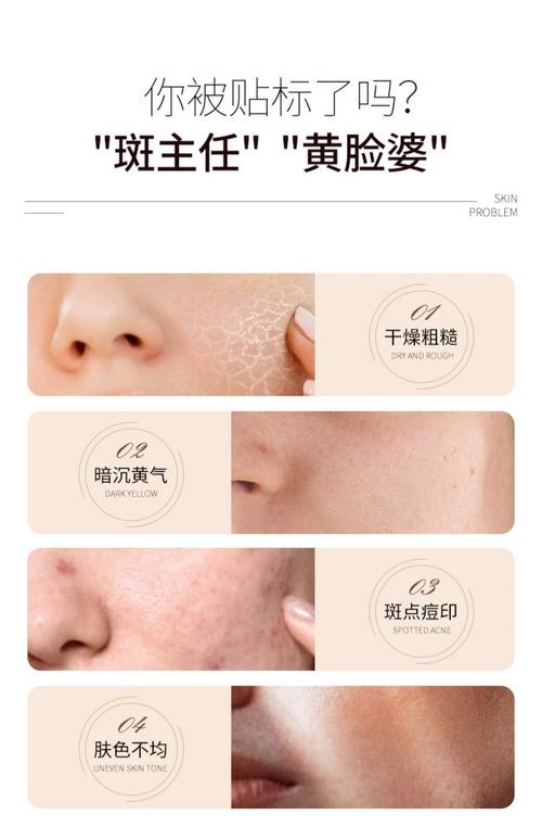 脸色发黄用什么护肤品比较好