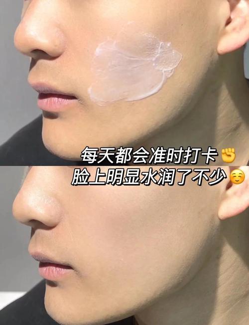 男士脸干起皮用什么护肤品