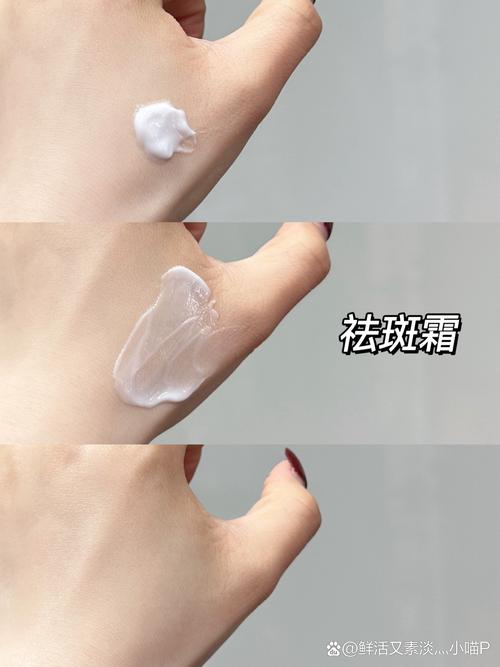 干性皮肤有斑用什么护肤品