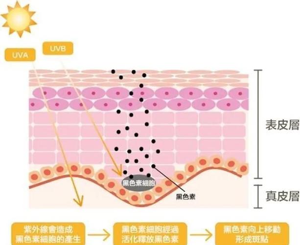 淡斑的原理是什么