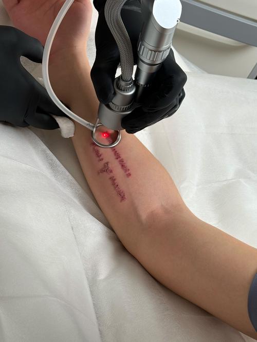 纹身用什么能洗掉