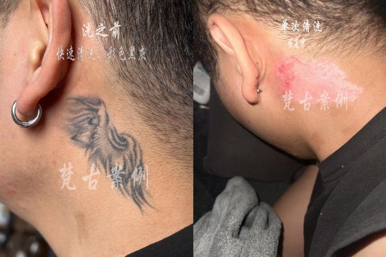 纹身用什么能洗掉