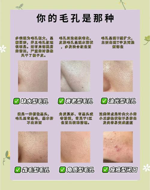 油皮毛孔粗大用什么护肤品