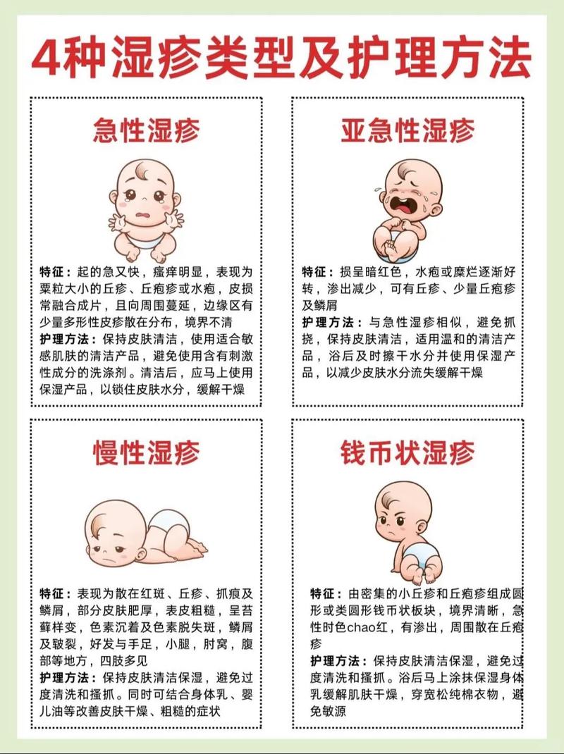 什么是婴儿湿疹