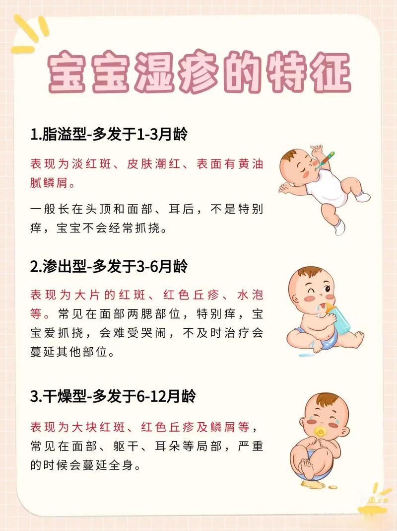 什么是婴儿湿疹