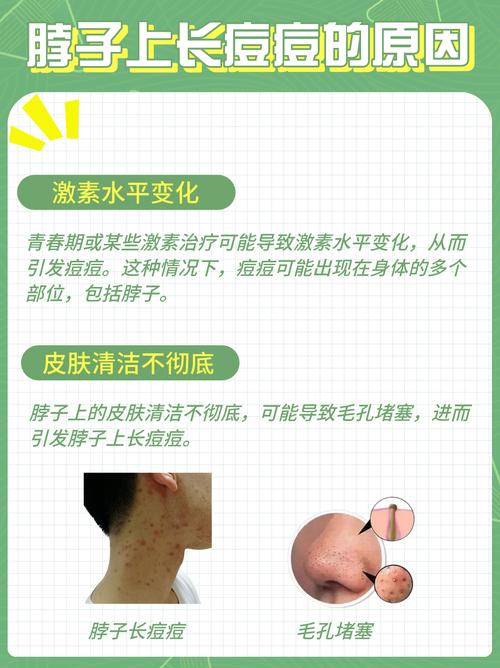 脖子长痘是什么原因