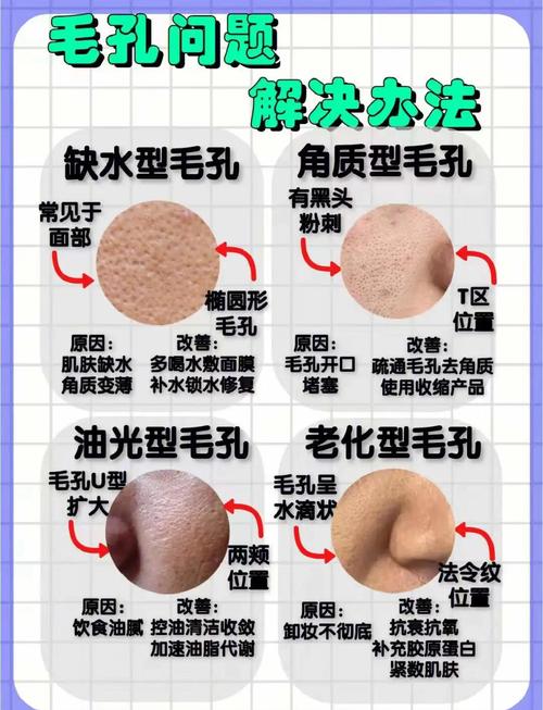 脸油毛孔粗大用什么护肤品