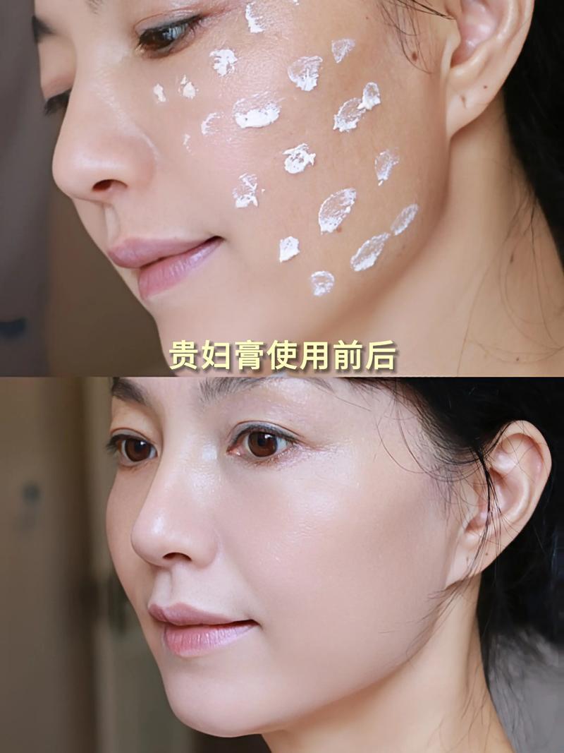 肤色暗沉发黄用什么护肤品