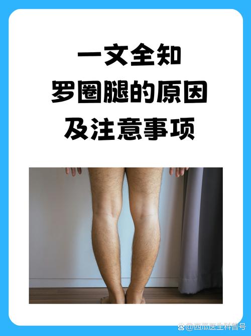 o型腿是什么样的