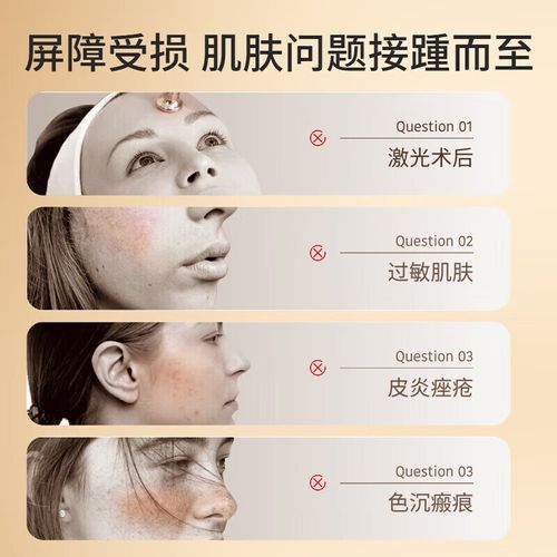 角质层比较薄用什么护肤品