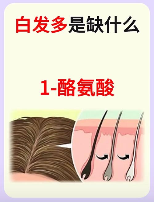 白头发是缺少什么