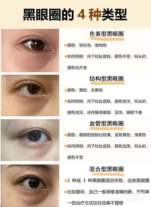 黑眼圈是缺什么