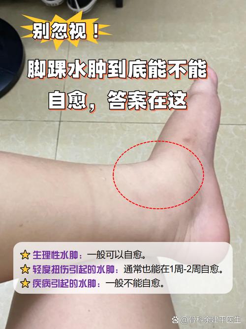 减肥期间为什么会水肿