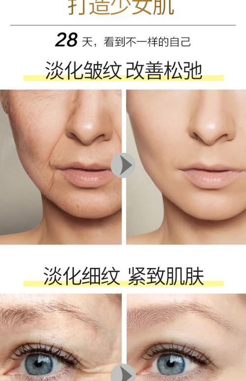 用什么可以去皱纹