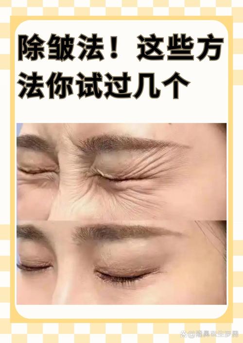 用什么可以去皱纹